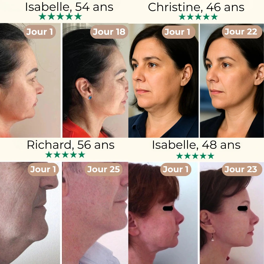 Masque Vline lifting double menton